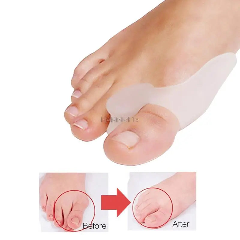 2 pieces = 1 pair of silicone toe separators, hallux valgus adjusters, external toe foot care tools, hallux valgus correctors D